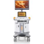 Аппарат УЗИ Siemens ACUSON S3000 — изображение 2