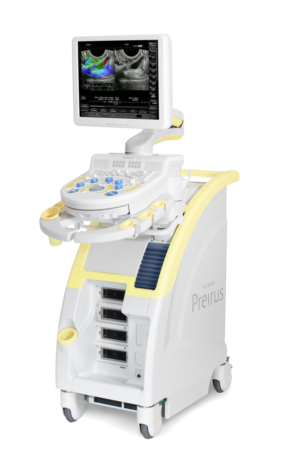 УЗИ аппарат Hitachi Hi Vision Preirus_69dabd1ea0092.png УЗИ аппарат Hitachi Hi Vision Preirus — изображение 1
