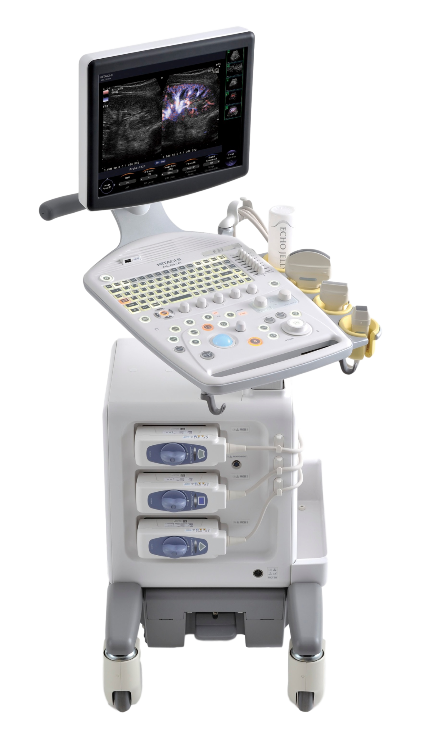 УЗИ аппарат Hitachi Prosound F31_69dabdee84bdc.png УЗИ аппарат Hitachi Prosound F31 — изображение 1