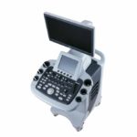 УЗИ аппарат SIUI Apogee 3500 elite — изображение 2