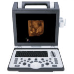 УЗИ аппарат SIUI CTS 7700 — изображение 2