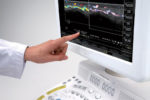 УЗИ сканер Hitachi Hi Vision Ascendus — изображение 3